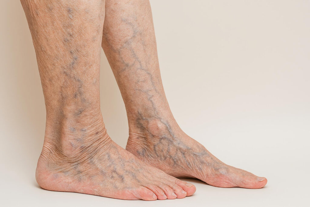Vascular Services